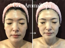 ココアロマ 神戸店の雰囲気（【人中短縮小顔コルギ】この骨の美容術ができのはココアロマだけ）