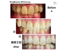 リングベリー 湘南茅ヶ崎(Ring Beauty)