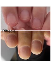 リフレシア(Rifrecia)/むしらなくなると♪