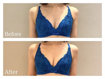 ククナ(KUKUNA)/*バストアップマッサージ*