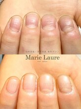 マリーロール 淀屋橋本店(Marie Laure)/自爪育成/深爪矯正/ネイルケア
