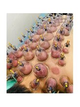 ほりきり整骨院/NEW【カッピング×インディバ】