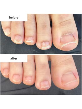 ケアプラス(care plus)/フットネイルケア