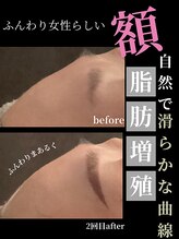 ノーブルノアール(Noble noir)/額ふっくら若見えケア