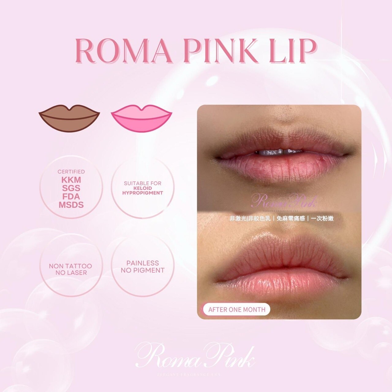 ローマピンク 札幌｜ホットペッパービューティー