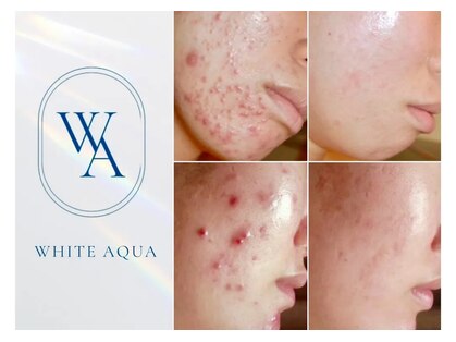 ホワイトアクア 北新地店( WHITE AQUA)の写真