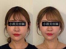 コガオ レンネ(Lenne)/継続することで自分史上１番へ