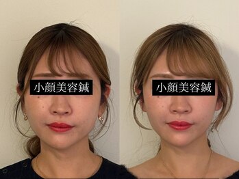 コガオ レンネ(Lenne)/継続することで自分史上１番へ