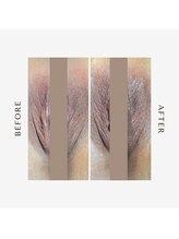 リノレア(LinoLea)/