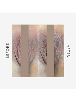 リノレア(LinoLea)/