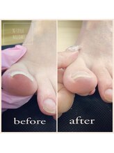 エヌスタイル(N-STYLE)/