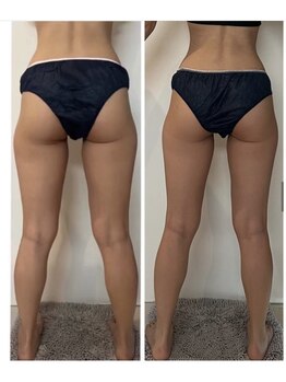 エムプリュ 心斎橋店(M.plus)/着るエステ