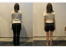 小顔矯正整体サロン イクサス(IxAS)/約3ヶ月/計6回の<before&after>