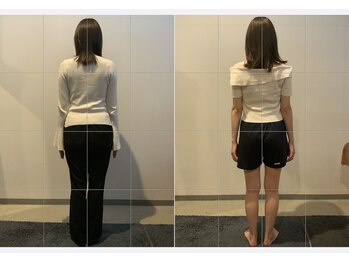 小顔矯正整体サロン イクサス(IxAS)/約3ヶ月/計6回の<before&after>