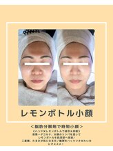 ソワナ(soina)/【神楽坂駅/フェイシャル/毛穴】