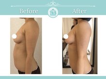 バストアップ専門店だから叶う☆バストを残したままダイエット！