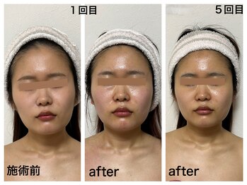 ダルセーニョ/顔の印象はここまで変わる。