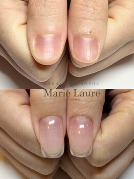 深爪矯正/自爪育成/ネイルケア