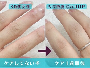アルファ バイ ティース(ALPHA by tis30)の写真/《待望のメニュー化★》肌のくすみ/しわ/シミ改善に特化したハンド本格エステ導入でお悩み根本改善を可能に