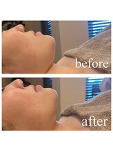 ディス イズ ミー エステティック(This is Me Aesthetic)/二重アゴ解消