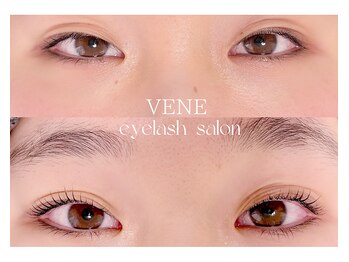 ウェヌ(VENE)/アイストレッチ＋ラッシュリフト
