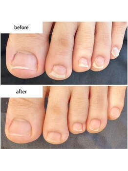 ケアプラス(care plus)/フットネイルケア