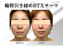 アールメディカルサロン 富山院(R Medical Salon)/脂肪燃焼小顔リフト