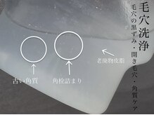 ビノスビューティー(vinos.beauty)/肌に蓄積した汚れはこんなにも！