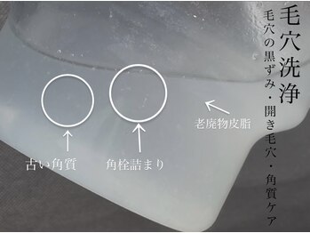 ビノスビューティー(vinos.beauty)/肌に蓄積した汚れはこんなにも！