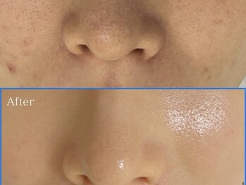 ギャラリー(GALLERY)/