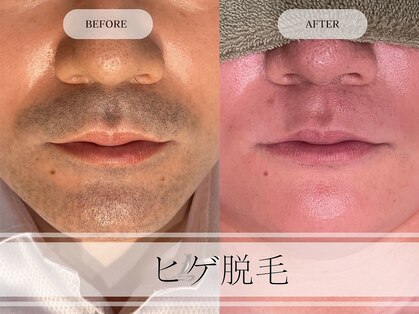メンズプラス(MEN’S PLUS)の写真
