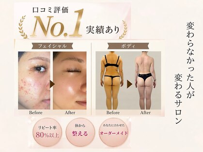 エステ大阪PONの写真