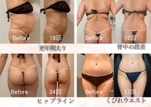 ラ ルーチェ 星田