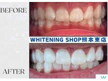 ホワイトニングショップ熊本東店/