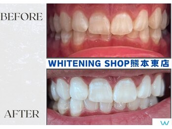 ホワイトニングショップ熊本東店/