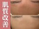 ザ ピーチ(THE PEACH)の写真
