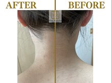 ヴェールブランシュ 町田(Vert Blanche)/#ブライダルエステ#シェービング