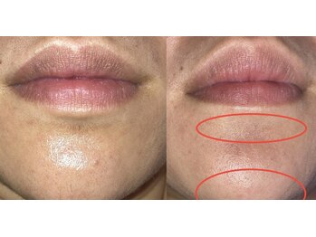 ニカ(NIKA)/毛穴レス&うるツヤ肌を同時に