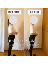 ブリリアントスマイル/美容矯正とファスティンぐで激痩