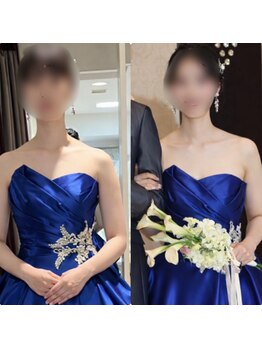 ティアエ(T-ae)/【ブライダルエステ】