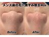 【メンズ】鼻の毛穴黒ずみ除去Wax ¥4,800→¥3,500