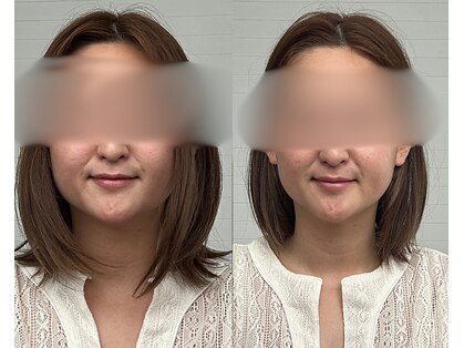 彩葉 結び(イロハ)の写真