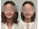 彩葉 結び(イロハ)の写真