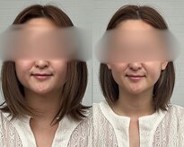 彩葉 結び(イロハ)