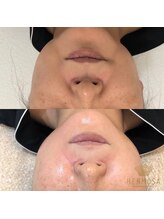 リアンビューティー(Lien Beauty)/気になる年齢肌徹底ケア！