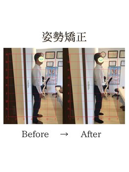 心斎橋長堀フェムテック整骨院/23姿勢矯正　骨格矯正と骨盤矯正
