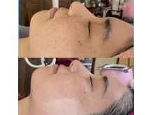 コモア(COMOA)/月1、1年での変化★