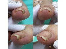 巻き爪補正店 西宮北口店の雰囲気（巻き爪や足のトラブルでお悩みの方もお気軽にご相談ください！）