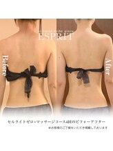 エスプリ 銀座店/銀座痩身・痩せる・ダイエット