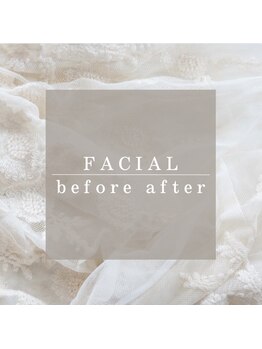 TD 一宮店/★フェイシャルbefore after★